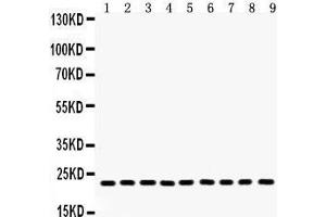 Anti- Peroxiredoxin 1 Picoband antibody, Western blotting All lanes: Anti Peroxiredoxin 1  at 0.