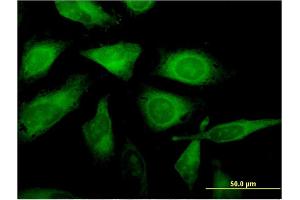 Immunofluorescence of monoclonal antibody to C1orf89 on HeLa cell. (RSG1 antibody  (AA 1-258))