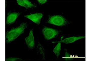 Immunofluorescence of monoclonal antibody to C1orf89 on HeLa cell.