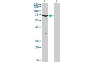 Western Blot analysis of EPB42 expression in transfected 293T cell line by EPB42 monoclonal antibody (M01), clone 2G12. (EPB42 antibody  (AA 623-721))