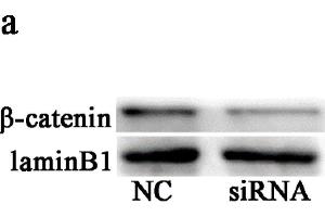 Knockdown of BAMBI suppressed Wnt/β-catenin signaling. (beta Catenin antibody  (AA 661-781))