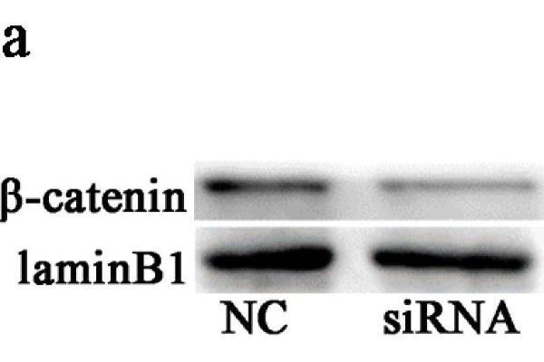 beta Catenin Antikörper  (AA 661-781)