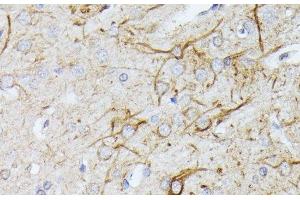 Immunohistochemistry of paraffin-embedded Rat brain using TBCA Polyclonal Antibody at dilution of 1:100 (40x lens). (TBCA antibody)