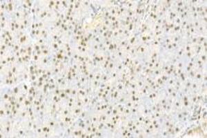 Immunohistochemistry analysis of paraffin-embedded rat pancreas using,IOP2 (ABIN7074883) at dilution of 1: 2000 (NARF antibody)