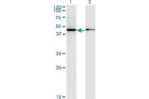 Western Blot analysis of ALLC expression in transfected 293T cell line by ALLC monoclonal antibody (M07), clone 3D3.