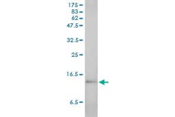 SAA1 antibody  (AA 1-122)