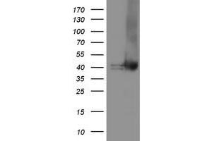 Western Blotting (WB) image for anti-Tubulin Folding Cofactor C (TBCC) antibody (ABIN1501322)