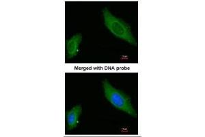 ICC/IF Image Immunofluorescence analysis of paraformaldehyde-fixed HeLa, using AKAP12, antibody at 1:200 dilution. (AKAP12 antibody  (C-Term))