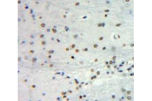 #VALUE! (SOX2 antibody  (AA 105-317))