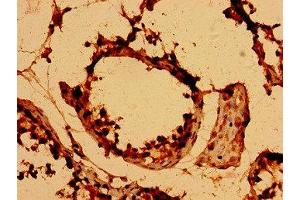 Immunohistochemistry of paraffin-embedded human testis tissue using ABIN7145480 at dilution of 1:100 (DEFB126 antibody  (AA 36-111))