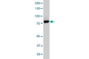 EPS8L2 monoclonal antibody (M01), clone 6C2 Western Blot analysis of EPS8L2 expression in A-431 . (EPS8-Like 2 antibody  (AA 615-714))