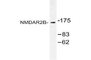Western blot (WB) analysis of NMDAR2B antibody in extracts from Jurkat cells. (GRIN2B antibody)