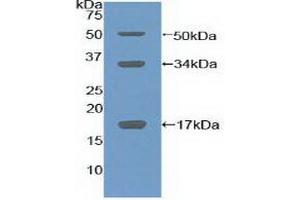 Detection of Recombinant COL10, Mouse using Polyclonal Antibody to Collagen Type X (COL10) (COL10 antibody  (AA 547-680))