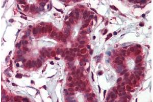 Human Breast (formalin-fixed, paraffin-embedded) stained with NOTCH4 antibody ABIN462184 followed by biotinylated goat anti-rabbit IgG secondary antibody ABIN481713, alkaline phosphatase-streptavidin and chromogen. (NOTCH4 antibody  (AA 371-420))