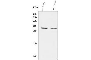 Western blot analysis of Calretinin/CALB2 using anti-Calretinin/CALB2 antibody (ABIN7603109). (Calretinin antibody  (AA 59-90))