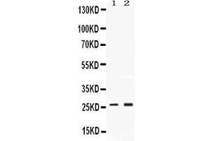 Western blot analysis of PSMA2 expression in rat testis extract ( Lane 1) and MCF-7 whole cell lysates ( Lane 2). (PSMA2 antibody  (Middle Region))