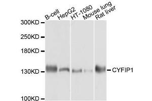 Western blot analysis of extracts of various cell lines, using CYFIP1 antibody.