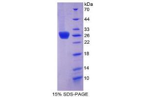 SDS-PAGE (SDS) image for Thrombospondin, Type I, Domain Containing 7A (THSD7A) (AA 42-242) protein (His tag) (ABIN1981249)