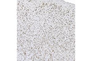 IHC analysis of hnRNP D/AUF1/HNRNPD using anti-hnRNP D/AUF1/HNRNPD antibody (ABIN7602592).