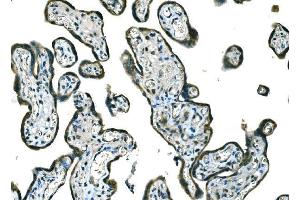 IHC analysis of B Raf/BRAF using anti-B Raf/BRAF antibody (ABIN3043761).