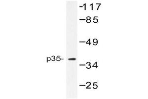 Image no. 1 for anti-Cyclin-Dependent Kinase 5, Regulatory Subunit 1 (p35) (CDK5R1) antibody (ABIN272233)