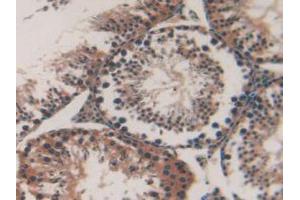 IHC-P analysis of Mouse Testis Tissue, with DAB staining. (MAP1A antibody  (AA 2552-2759))