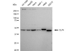Western blotting analysis using ELP4 antibody (ABIN7798433). (Recombinant ELP4 antibody)