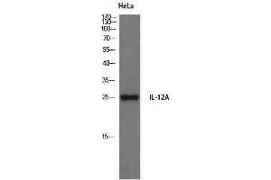 Western Blotting (WB) image for anti-Interleukin 12 alpha (IL12A) (Internal Region) antibody (ABIN3185157) (IL12A antibody  (Internal Region))