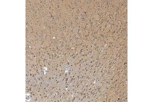 IHC analysis of SNPH using anti-SNPH antibody (ABIN7601724). (Syntaphilin antibody  (AA 43-482))