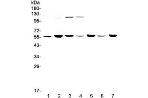 Western blot testing of human 1) HeLa, 2) MDA-MB-453, 3) Jurkat, 4) HepG2, 5) SK-OV-3, 6) PANC-1 and 7) mouse thymus lysate with CHRNA3 antibody at 0. (CHRNA3 antibody)