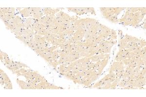 Detection of FABP4 in Porcine Cardiac Muscle Tissue using Monoclonal Antibody to Fatty Acid Binding Protein 4 (FABP4) (FABP4 antibody  (AA 2-132))