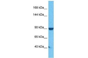 Host:  Rabbit  Target Name:  Atp6v0a1  Sample Tissue:  Human DLD1 Whole Cell  Antibody Dilution:  1ug/ml (ATP6V0A1 antibody  (C-Term))