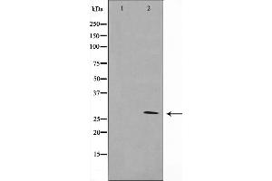 Western blot analysis of 14-3-3 zeta/delta expression in K562 whole cell lysates,The lane on the left is treated with the antigen-specific peptide. (14-3-3 zeta antibody  (C-Term))