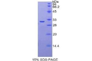 SDS-PAGE analysis of Rat Lactoperoxidase Protein.