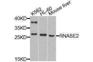 Western blot analysis of extracts of various cell lines, using RNASE2 antibody (ABIN6003657) at 1/1000 dilution. (RNASE2 antibody)