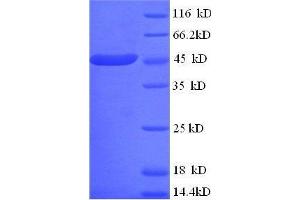 CKMT1 Protein (AA 40-417, full length) (His tag)