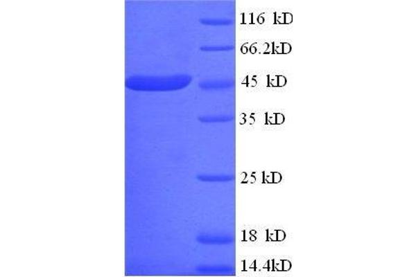 CKMT1 Protein (AA 40-417, full length) (His tag)