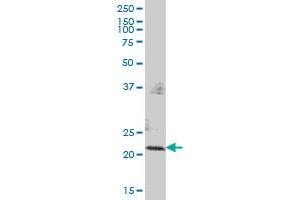 PMVK MaxPab polyclonal antibody. (PMVK antibody  (AA 1-192))
