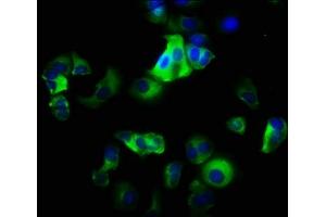 Immunofluorescence staining of MCF-7 cells with ABIN7156430 at 1:200, counter-stained with DAPI. (ITGA2 antibody  (AA 188-365))