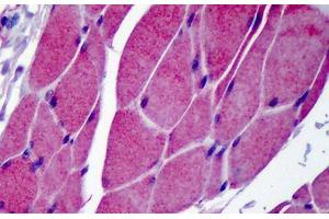Human Skeletal Muscle: Formalin-Fixed, Paraffin-Embedded (FFPE) (TRPC3 antibody  (C-Term))