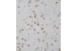 D staining MeCP2 in mouse brain tissue sections by Immunohistochemistry (IHC-P - paraformaldehyde-fixed, paraffin-embedded sections). (MECP2 antibody  (AA 400-428))