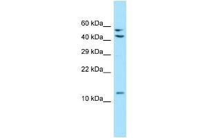 WB Suggested Anti-MRPL41 Antibody Titration: 1. (MRPL41 antibody  (C-Term))