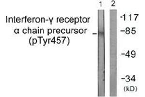 Western blot analysis of extracts from COS7 cells, using Interferon-gamma Receptor alpha (Phospho-Tyr457) Antibody. (IFNGR1 antibody  (pTyr457))