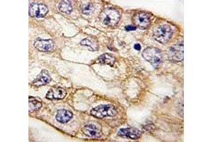 Immunohistochemistry (IHC) image for anti-CD8a Molecule (CD8A) (AA 150-180) antibody (ABIN3030431)