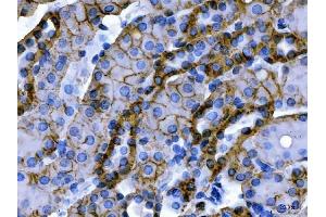 IHC analysis of ATP1B1 using anti-ATP1B1 antibody (ABIN7602014).