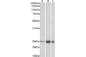 ABIN1590144 (1 µg/mL) staining of Human (A), Mouse(B) and Rat (C) Skeletal Muscle lysate (35 µg protein in RIPA buffer). (TNNI2 antibody  (AA 83-95))