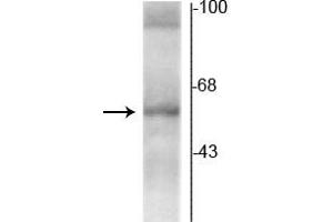 Western blot of rat hippocampal lysate showing specific immunolabeling of the ~58 kDa TR-α2 protein. (THRA antibody  (C-Term))