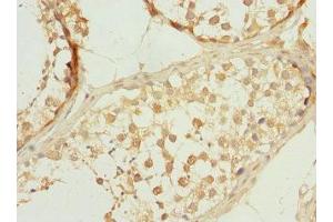 Immunohistochemistry of paraffin-embedded human testis tissue using ABIN7146273 at dilution of 1:100 (Calcineurin B antibody  (AA 1-170))