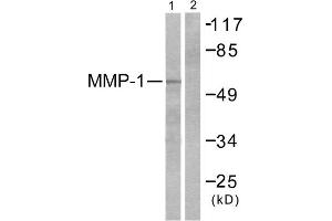 Western blot analysis of extracts from HepG2 cells, using MMP-1 antibody (ABIN5976455). (MMP1 antibody  (C-Term))