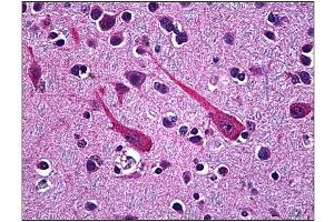 Immunohistochemistry (IHC) image for anti-Proprotein Convertase Subtilisin/kexin Type 1 (PCSK1) (AA 652-754) antibody (ABIN781869) (PCSK1 antibody  (AA 652-754))